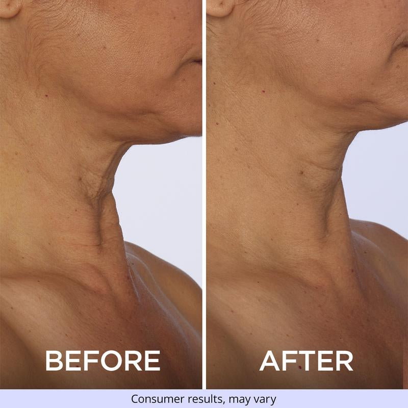 Revitalize Your Neck & Chest with GOPURE's Firming Cream for Youthful Skin